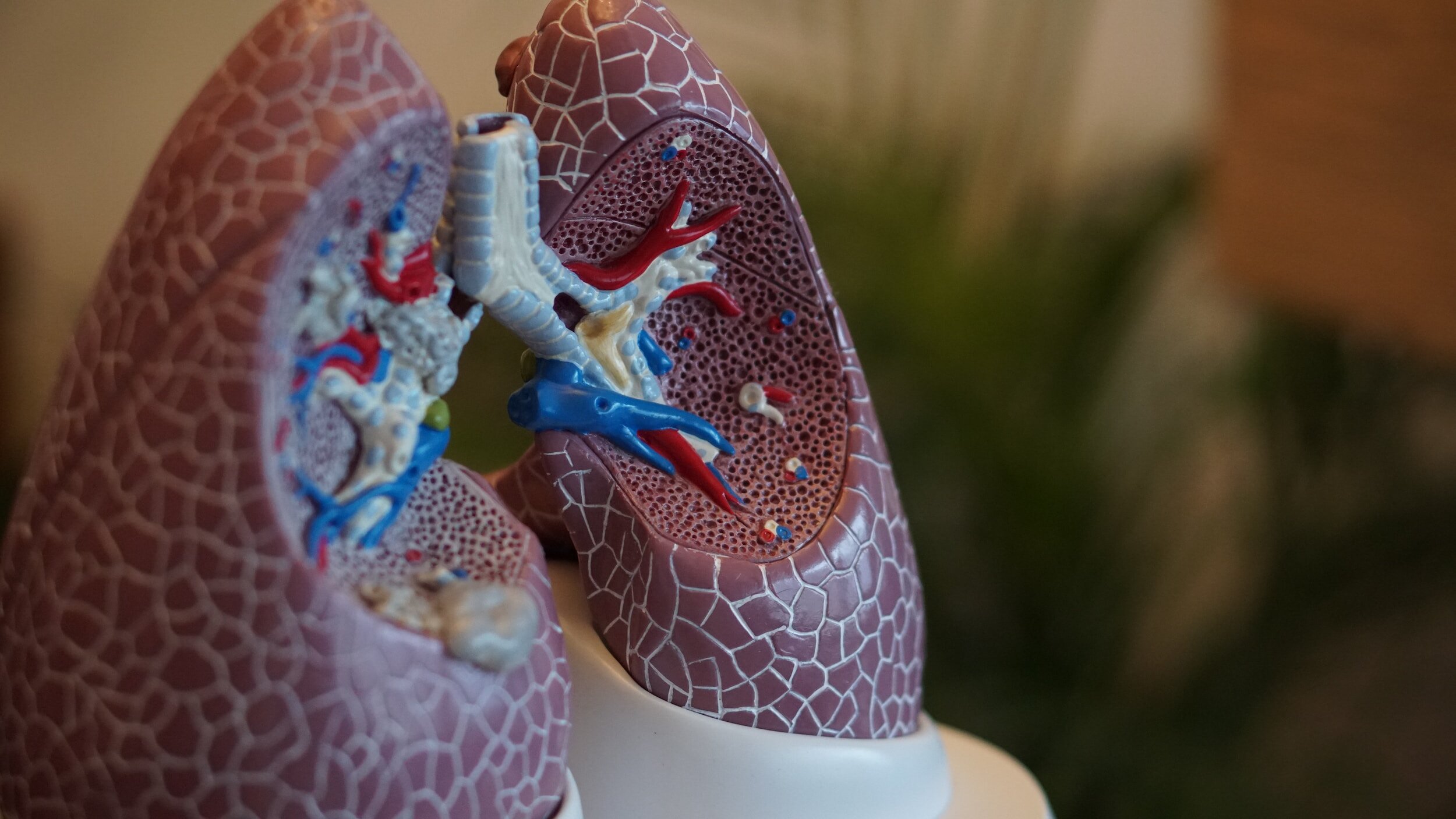 Comparing Cystic Fibrosis and Pulmonary Fibrosis